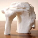 ابزار کمک جراحی شخصی سازی شده Patient Specific Guid